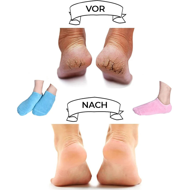 Feuchtigkeitsspendende Socken mit Gelfutter für die Fußpflege